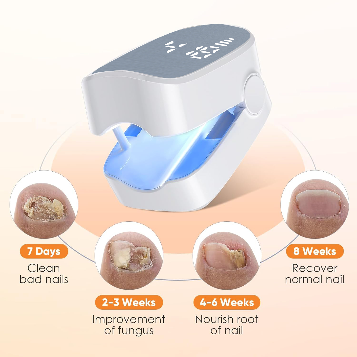 1 ชิ้นที่มีประสิทธิภาพชาร์จเชื - Industrial Laser Removal บทวิจารณ์และราคา